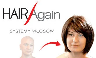 Hair replacement systems